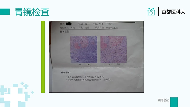 胸外科病例汇报PPT演示文稿免费下载免费PPT
