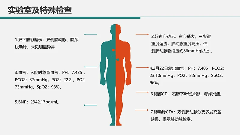 心内科护理查房肺栓塞病人的护理PPT演示文稿免费下载免费PPT