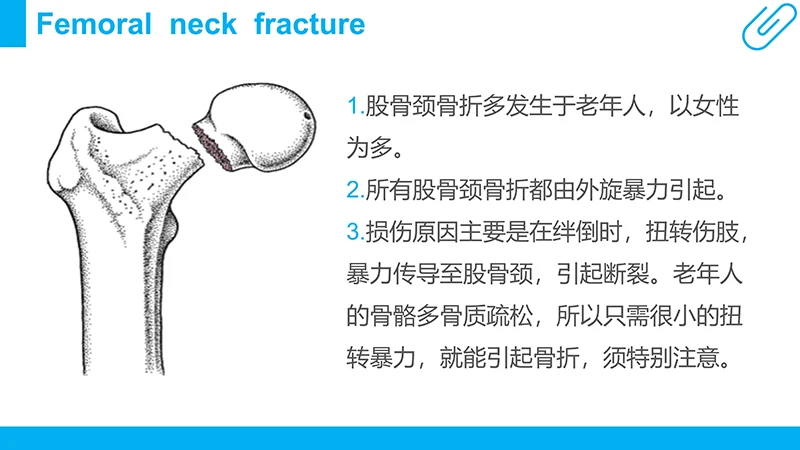股骨颈骨折病例分析演示文稿免费下载免费PPT