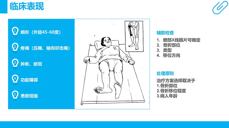 股骨颈骨折病例分析演示文稿免费下载免费PPT