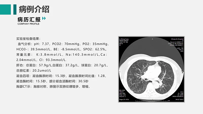 呼吸衰竭的护理查房ppt演示文档免费下载免费PPT