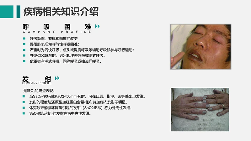 呼吸衰竭的护理查房ppt演示文档免费下载免费PPT