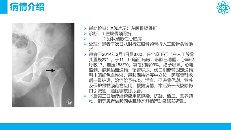 股骨颈骨折护理查房ppt演示文档免费下载免费PPT