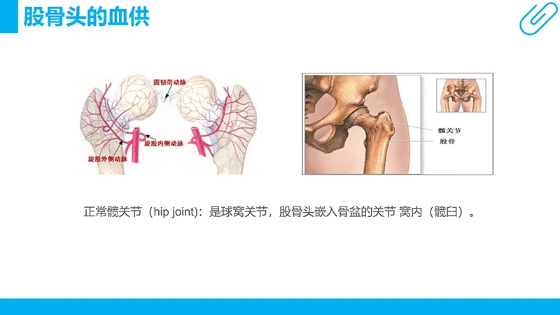 股骨颈骨折护理查房ppt演示文档免费下载免费PPT