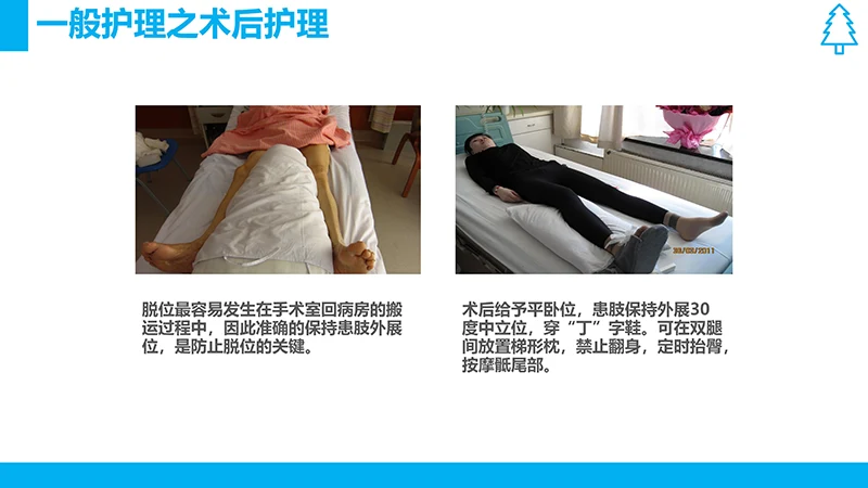 股骨颈骨折护理查房ppt演示文档免费下载免费PPT