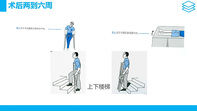 股骨颈骨折护理查房ppt演示文档免费下载免费PPT