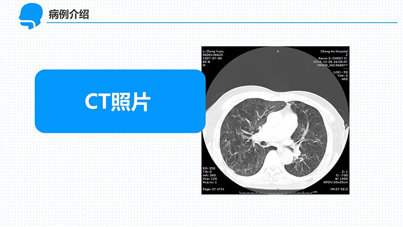 呼吸衰竭的护理查房ppt演示文档免费下载免费PPT