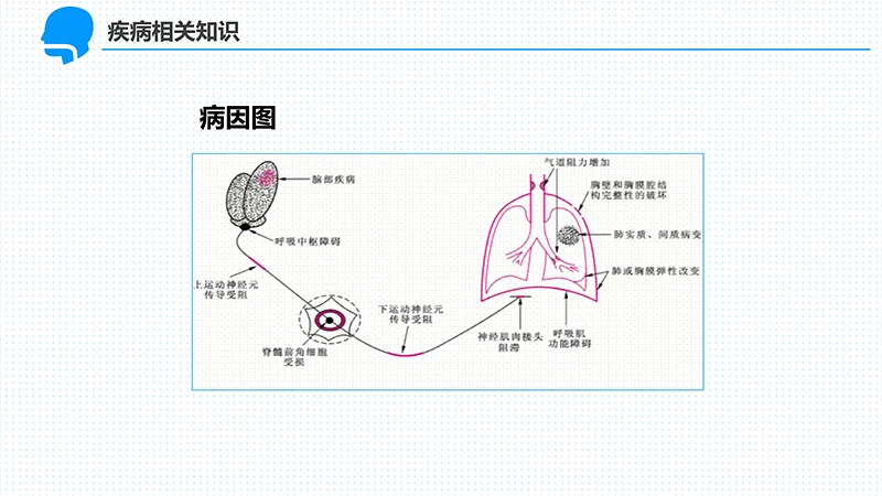 呼吸衰竭的护理查房ppt演示文档免费下载免费PPT