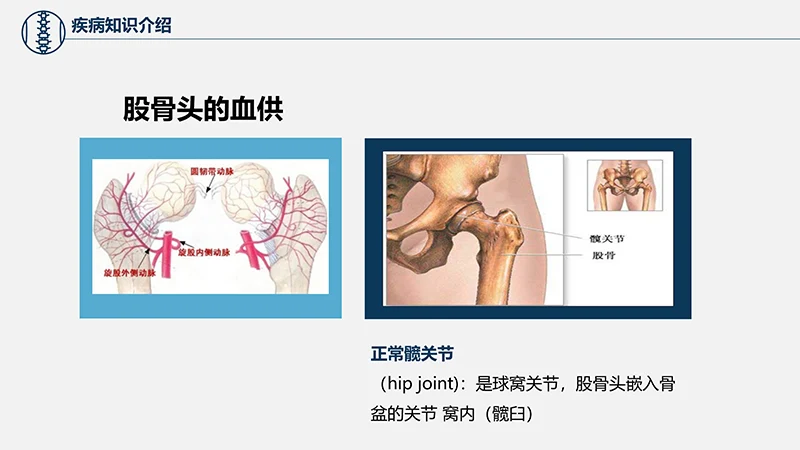 关注病人健康股骨颈骨折护理查房ppt演示文档免费下载免费PPT