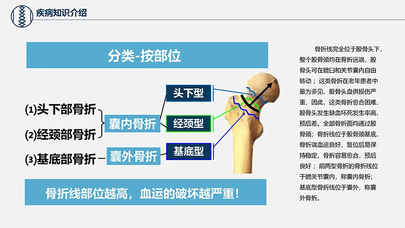 关注病人健康股骨颈骨折护理查房ppt演示文档免费下载免费PPT