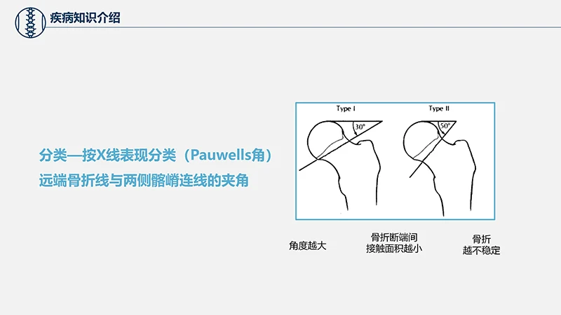 关注病人健康股骨颈骨折护理查房ppt演示文档免费下载免费PPT