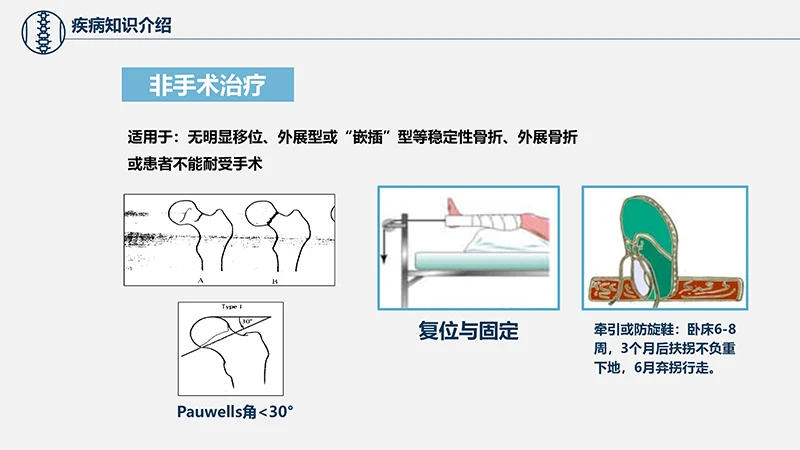关注病人健康股骨颈骨折护理查房ppt演示文档免费下载免费PPT