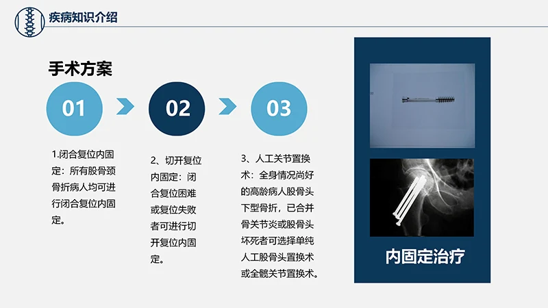 关注病人健康股骨颈骨折护理查房ppt演示文档免费下载免费PPT