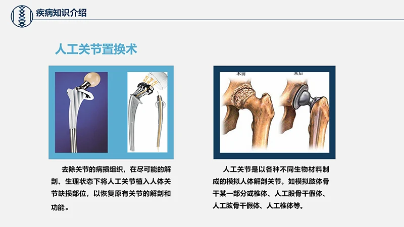 关注病人健康股骨颈骨折护理查房ppt演示文档免费下载免费PPT