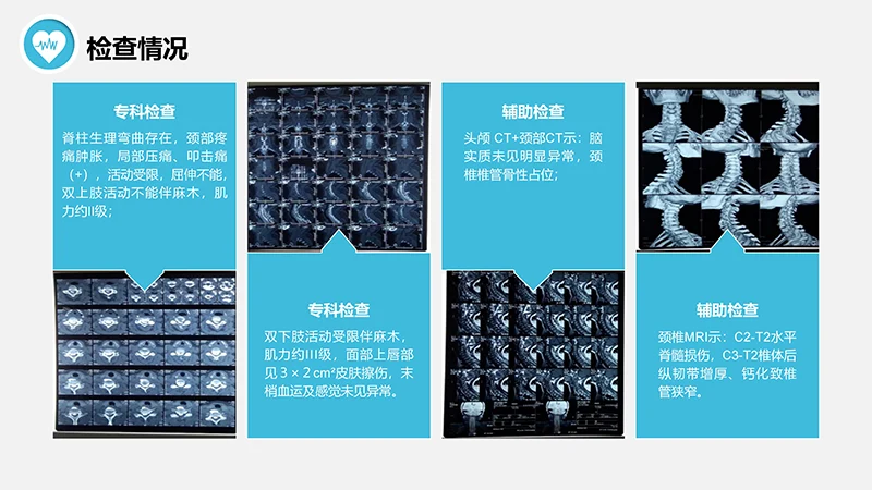 脊髓损伤的护理查房ppt演示文档免费下载免费PPT