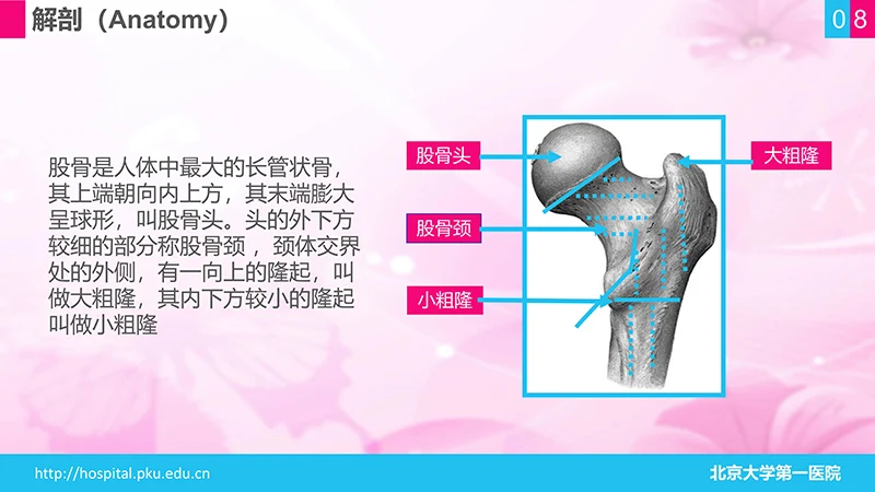 股骨颈骨折护理查房ppt演示文档免费下载免费PPT