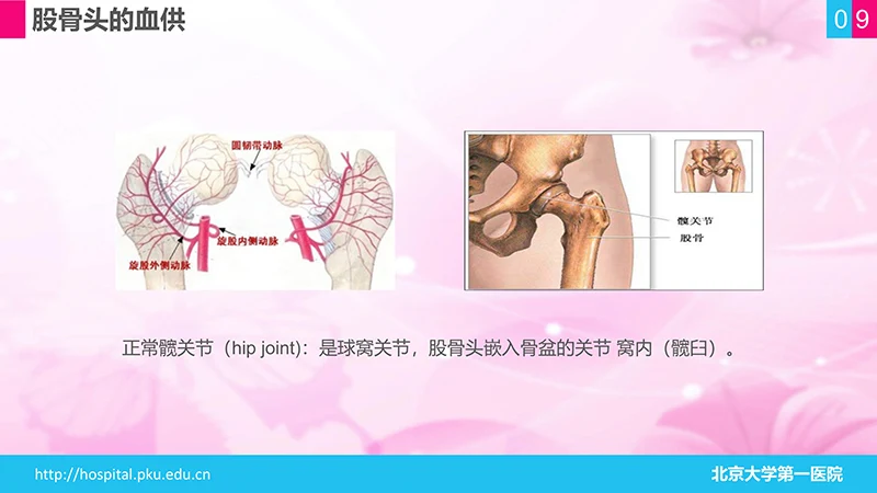 股骨颈骨折护理查房ppt演示文档免费下载免费PPT
