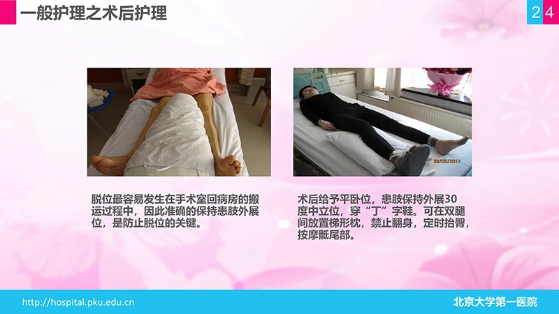 股骨颈骨折护理查房ppt演示文档免费下载免费PPT