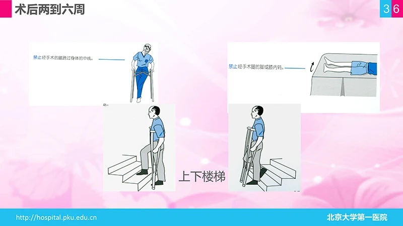 股骨颈骨折护理查房ppt演示文档免费下载免费PPT